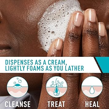 CeraVe Acne Foaming Cream Cleanser – 4% Benzoyl Peroxide (120ml) | Dermatologist-Developed Acne Treatment
