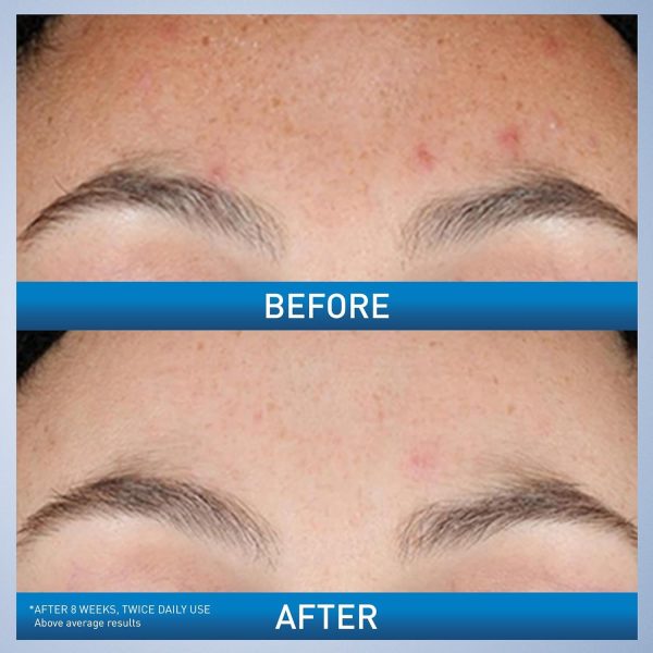 Cerave Retinol Serum – Fade Acne Marks & Brighten Skin | 30ml