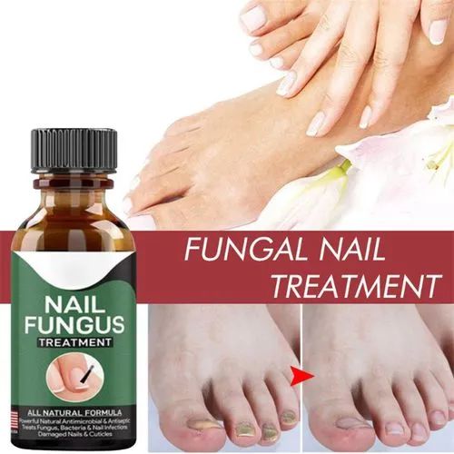 Fast Nail Fungal Treatment Gel – Repair Essence for Damaged Nails